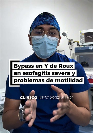 🔸 Bypass gástrico en Y de Roux en esofagitis severa y alteraciones de la función esofágica Se realizó una reparación de la hernia hiatal y un bypass para resolver el reflujo, además de que ayudará con una pérdida importante de peso y control metabólico (Diabetes, hipertensión). ✅ Solución al reflujo gastro esofágico y control de la esofágitis. ✅ Adecuada pérdida de peso control metabólico de enfermedades como diabetes mellitus, hipertensión arterial, dislipidemia, etc. ¿Quieres saber más acerca
