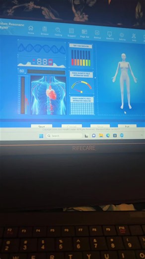 ✨ Discover the Root Cause, Not Just the Symptoms ✨ Bioresonance therapy is a gentle, non-invasive wellness approach designed to help identify potential underlying imbalances, energetic stressors, and possible nutritional deficiencies that may be affecting your overall wellbeing. Rather than focusing only on symptoms, bioresonance aims to provide valuable insights that can help guide a personalised wellness plan and support your body's natural balance. Our Services 🌿 Bioresonance Scan & Consulta