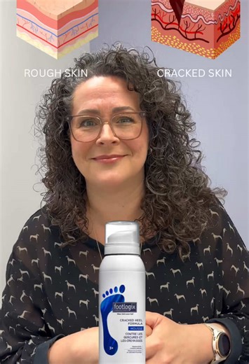 Footlogix Cracked Heel Formula for Deep Cracks