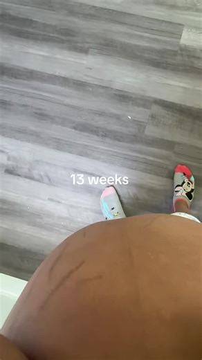 Understanding Pregnancy at 13 Weeks