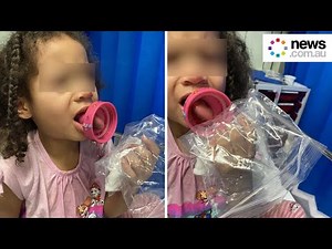 Mum's warning as girl's tongue stuck in bottle