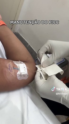 Entendendo o Cateter PICC: Funcionamento e Cuidados
