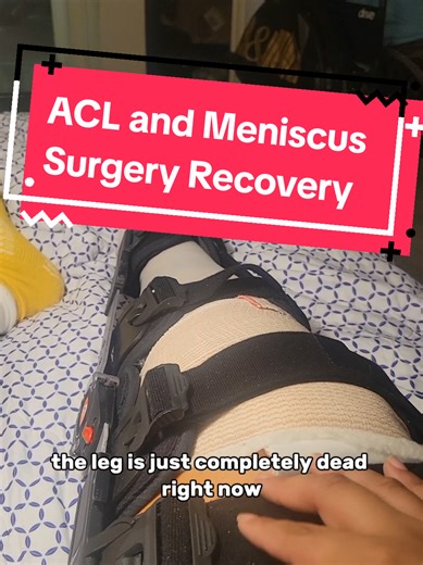 I tore my ACL, and it has been difficult to do the chika dance now lol #chikadanceforlife #esteblook #chikadance #kaguyasamaloveiswar #anime