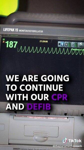 Have you seen V-Tach with a pulse? 🚑 #emt #paramedic #ekg #nremt