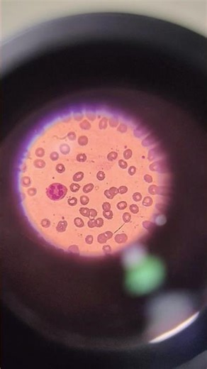 #bmlt #motivation #medicalexamination #medicalbiochemistry #science