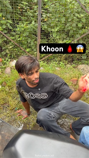 Khoon nikal gaya accident mai 😱 first time in Scooty #rahulyadavsdl #comedy #scooty #youtubeshorts