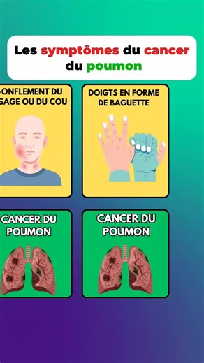 Les signes du cancer du poumon à ne jamais ignorer