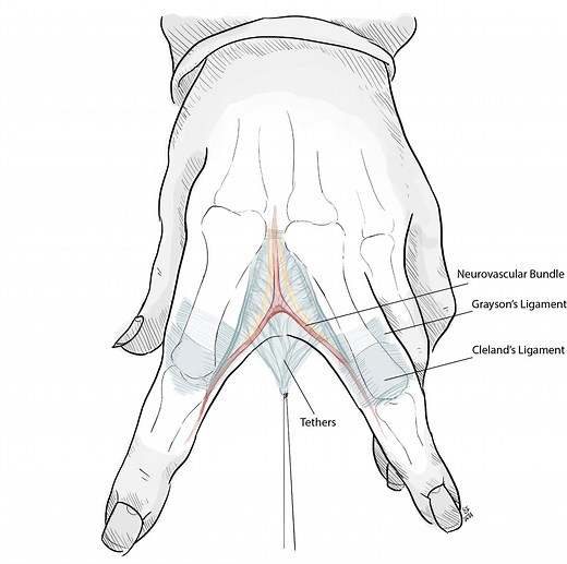 Hand Web Space Tethers — The Cinderella Layer and Fascia Tethers