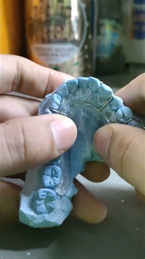 Hawley Retainers #reels #dentaltechnicianlife