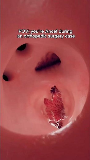 Ancef is the most common antibiotic we give in orthopedic surgery #surgery #orthopedicsurgeon