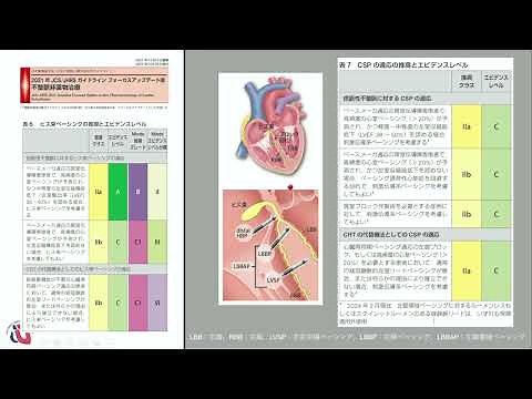 2024年JCS/JHRS ガイドライン フォーカスアップデート版 不整脈治療