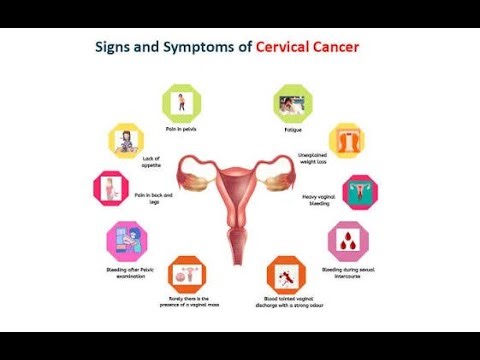 Clinical Features and Diagnosis of Cervical Intraepithelial Neoplasia