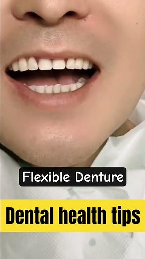 Flexible Denture ‪@DentalHealthTips‬