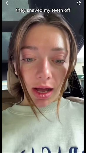 Effective Treatments for Dental Erosion: Bonding vs. Veneers