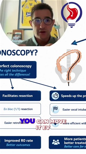Perfect Colonoscopy: Detecting More, Changing Lives #shorts