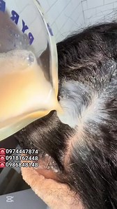 ☎️0974447874 #hairtnansformatio #feghairgrowspraybenefits #hairoilsforgrowthl #hairtnansformation #minoxdel #HairGoals2025 #tnansformation #Noor #hairgol | እናት ኮስሞ