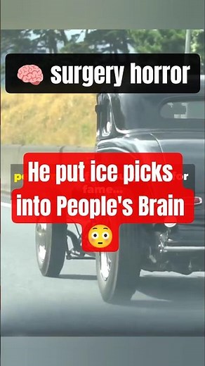 Doctor or Monster?🤨 The Dark Truth of Lobotomy