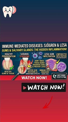Sjögren Syndrome Explained | Dry Mouth & Dry Eyes | Full Video on Last Night Dentistry