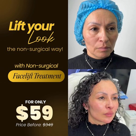 👋 Ladies in Orange and surrounding areas, struggling with sagging cheeks, wrinkles, or loose skin? See results in just 1–2 sessions with our Non-Invasive Facelift Treatment! Our advanced treatment helps: ✅ Firm sagging cheeks and neck ✅ Smooth fine lines and wrinkles ✅ Restore elasticity and radiance ✨ For a limited time, get your first Non-Surgical Facelift Treatment for only $59 (Reg. $349) — save $290! Offer available to the first 15 new clients this month. 👉 Click LEARN MORE to reserve you