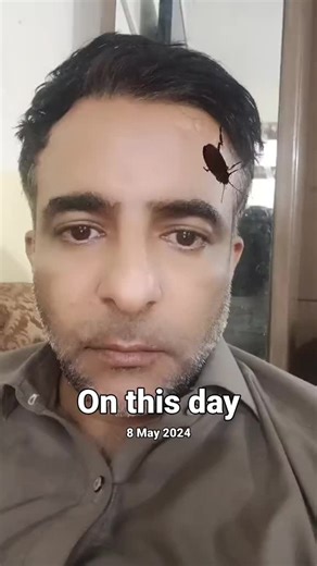 Understanding Bug Behavior on Human Skin