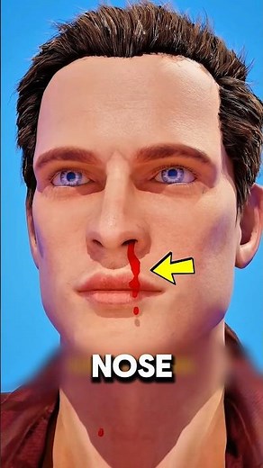 Why Do Nosebleeds Happen Suddenly? 🤧🩸