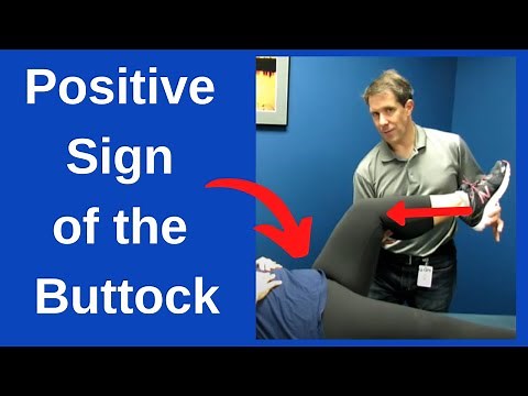 Positive Sign of the Buttock Test