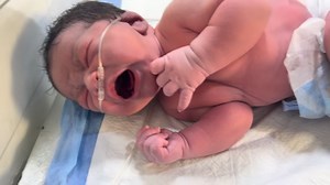 Successful Normal Delivery of a 4.4kg Macrosomic Baby” #adoreble #cutebaby #cutebabies #newborn #adorably | Anoop Gautam