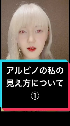 アルビノの私の見え方について