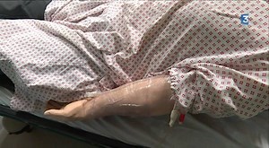 La Roche-sur-Yon : un mannequin pour former aux soins d’urgence ►pdl.france3.fr C’est une grande avancée pour les vendéens. Le Centre d’enseignement aux soins d’urgence de la Roche-sur-Yon vient de se doter d’un mannequin. Un outil qui va permettre aux médecins et aux infirmières de mieux se préparer aux gestes techniques à l’hôpital. | France 3 Pays de la Loire