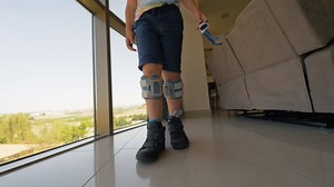 Kid undergoing functional electrical stimulation therapy with foot drop system