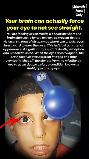 Why Does Your Brain Forces You to see with One Eye 🤯