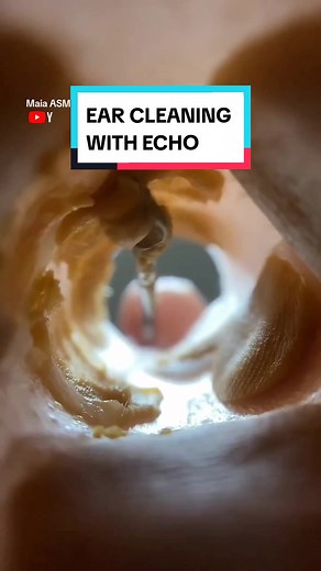 Satisfying Echo Ear Cleaning with Maia ASMR Gamer