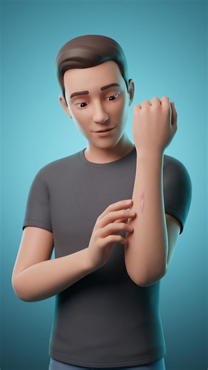 ¿Sabías cómo se forma realmente una cicatriz? 🩹#cuerpohumano #ciencia #curiosidades #3d