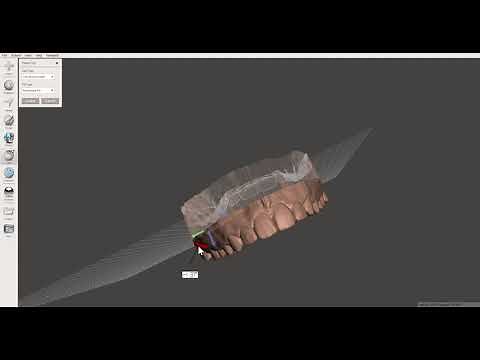 Preparing dental models in MeshMixer for 3D printing