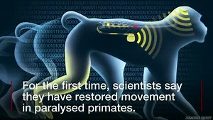 "Brain wi-fi" technology gives hope to paralysed patients. More on the path to human treatment here 📻 http://bbc.in/2g1kBVh | BBC World Service