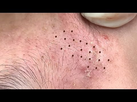 Satisfying and Relaxation with SURI NGUYEN Beauty Spa Video #186