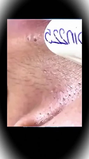 ‏これはえぐい #耳垢 #耳くそ #耳子 #気持ちいい瞬間 #耳かき動画 #耳掃除 #観覧注意 #お掃除スペシャリスト