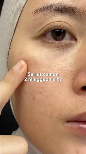 Review skintific retinol renewal moisturizer #skintific #retinol #retinoids #retinolskincare
