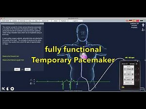 Epicardio Simulation™ Temporary Cardiac Pacing