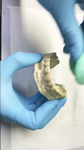 How to make Essix retainer with tooth.