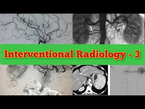 Radiology Viva Cases # 168-171 | Interventional Radiology Exam Cases #medical #radiology #ultrasound