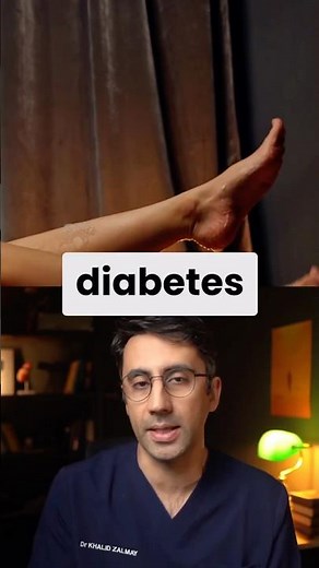 Diabetes WARNING Signs in Feet / Legs #type2diabetes #diabetessigns #prediabetes