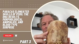 Paracas Elongated Skulls of Peru: Part 3