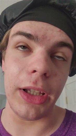 JOIN THE FORTNITE LIVE STREAM!!!