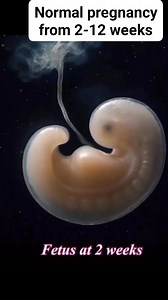 23K reactions · 1.4K shares | Normal pregnancy from 2-12 weeks #pregnancy #fetus #fetalmedicine #fetusdevelopment | Radiology Interesting | Facebook