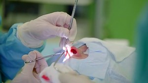 doctor is performing medical manipulation with nose of patient under anesthesia in operating room