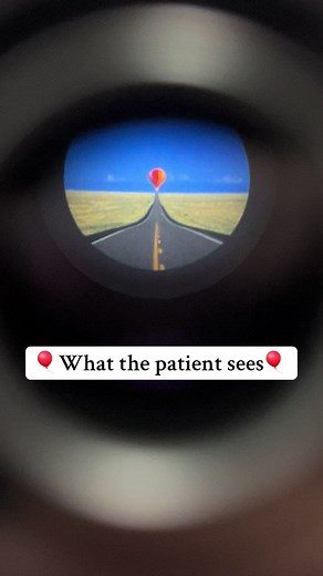 Understanding Eye Exams: Patient vs. Technician Perspectives