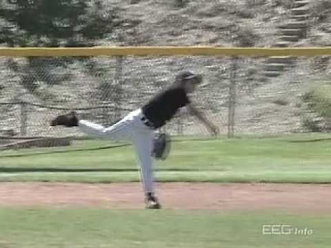 Neurofeedback for ADHD - EEG Info Videos