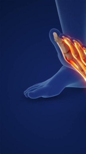 Foot Pain Symptom Map by Area