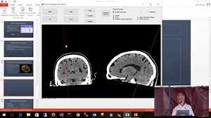 Digital Medical Imaging - from scanner to screen.